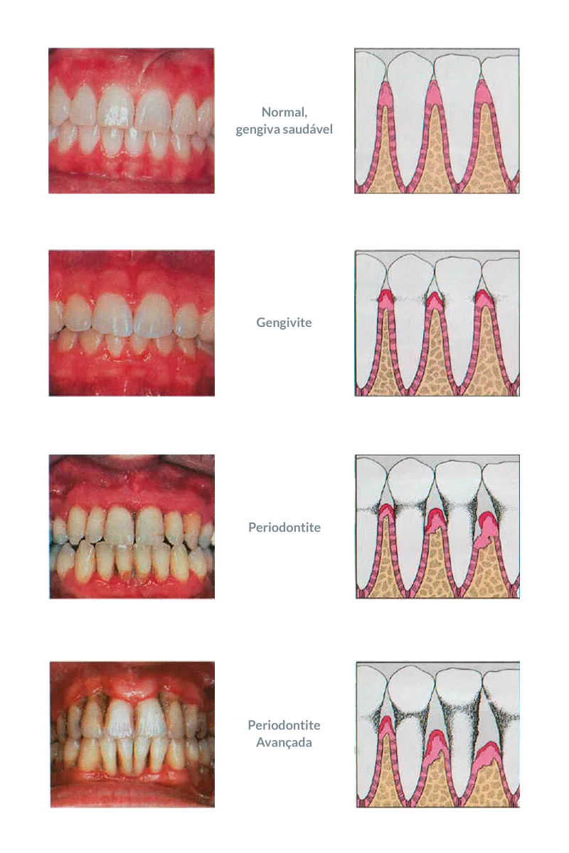 perio-transp